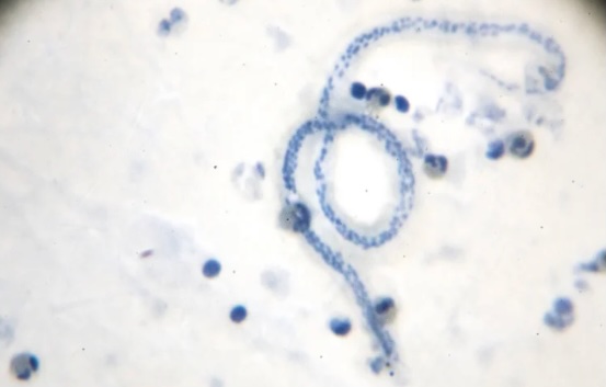 ミクロフィラリア
犬の命を守る！フィラリア症の予防と対策ガイド　獣医師監修４
